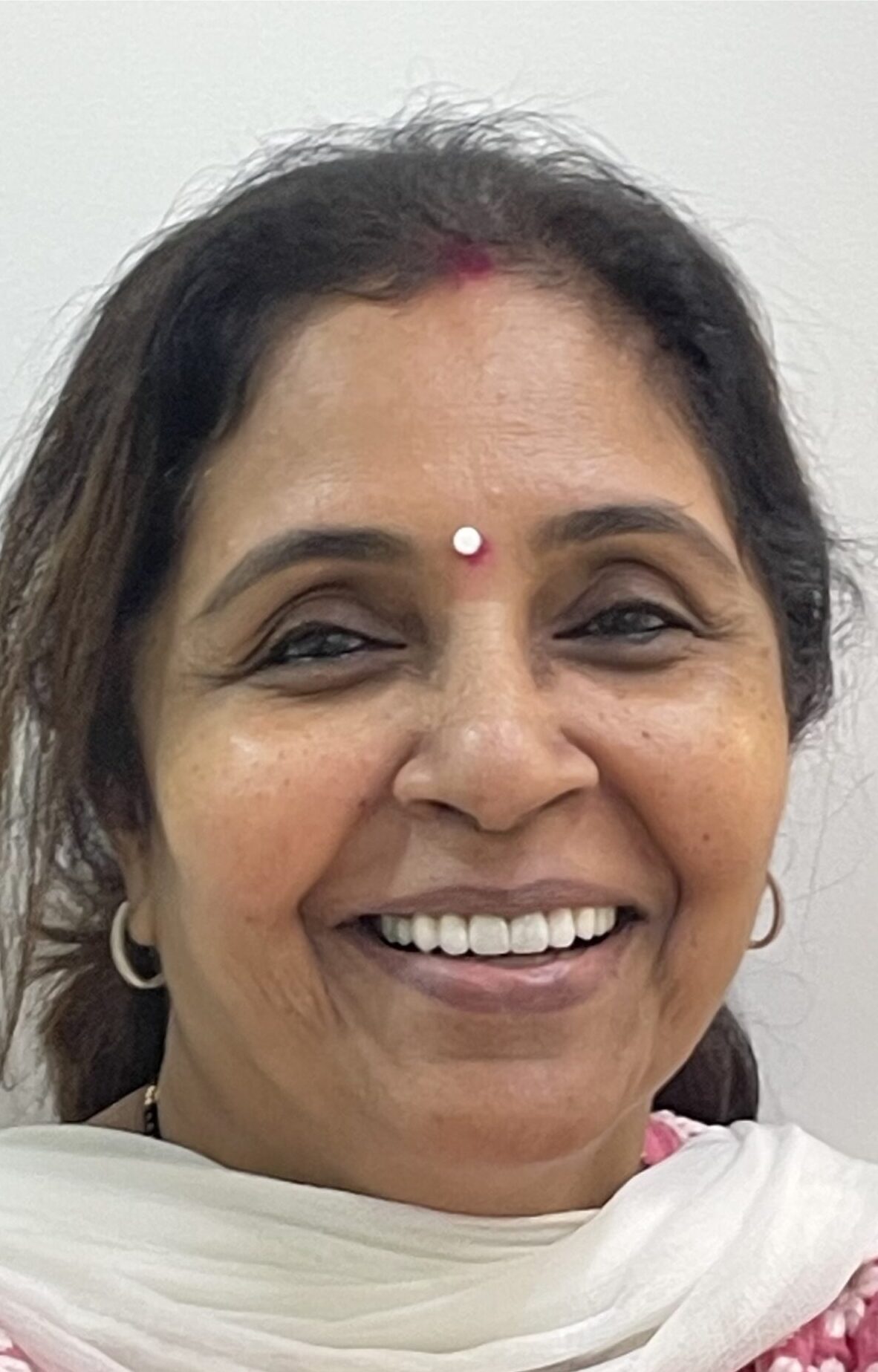 After - Complete Smile Makeover