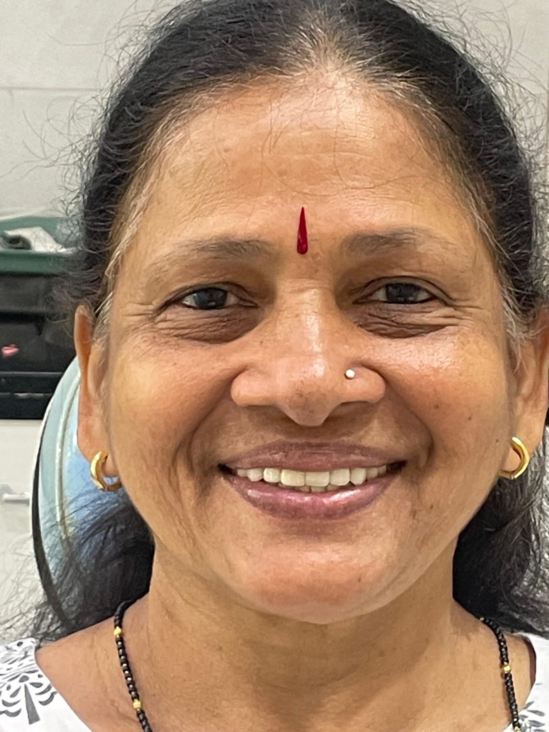 After - Dental implement