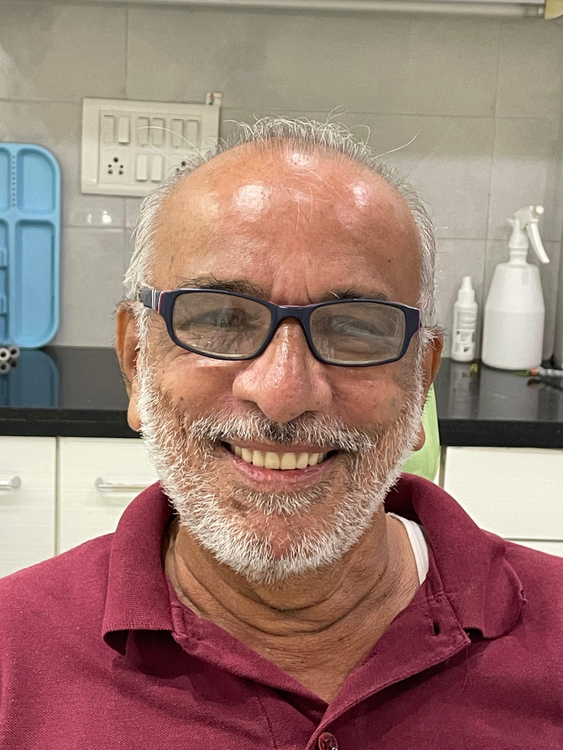 After - Implant Treatment